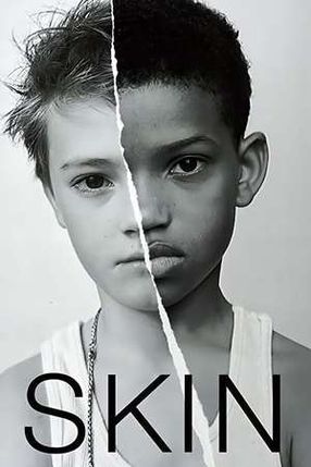Poster: Skin